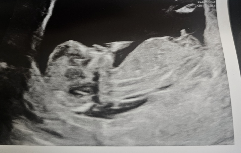 12 weeks nub theory