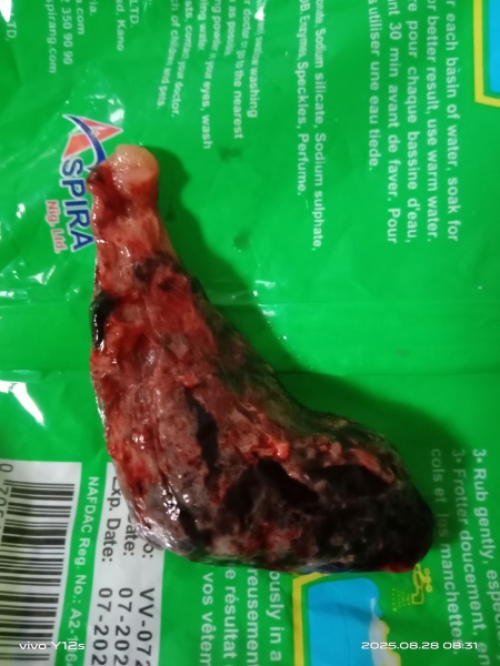 Is this my baby? *Warning graphic pic! *