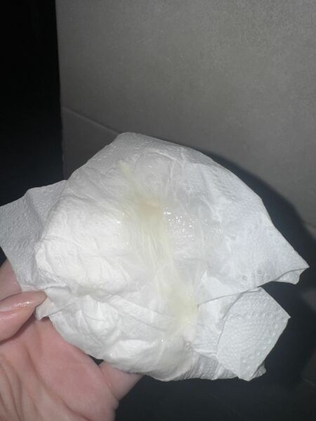 Is this my mucus plug?