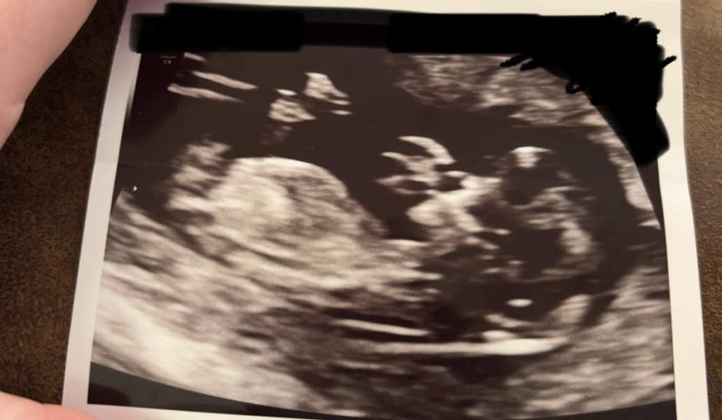 Unclear scan pic - guesses?
