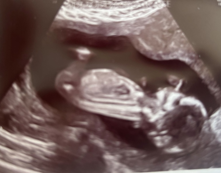 Any guesses gender