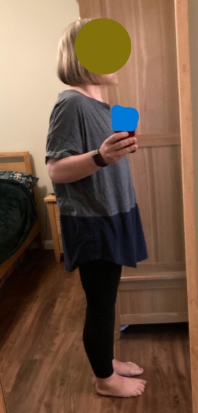 Mounjaro 10st (or more) to lose Thread 8