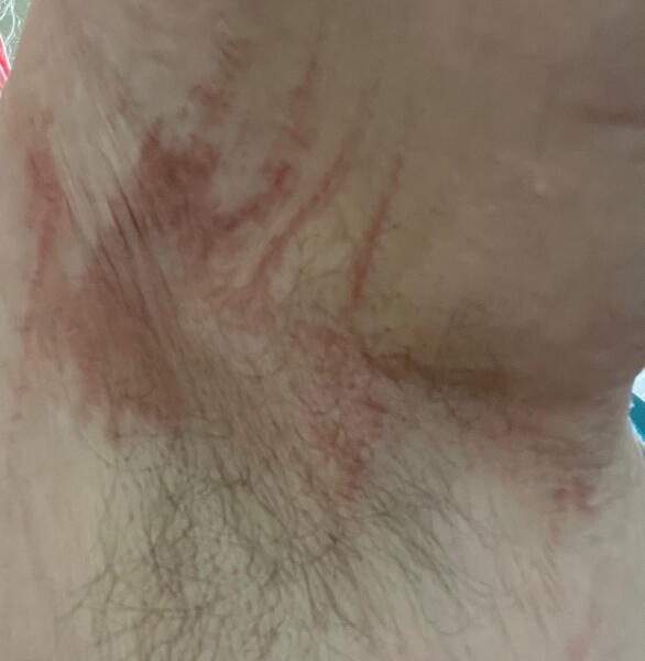 Message from Mitchum regarding skin issues