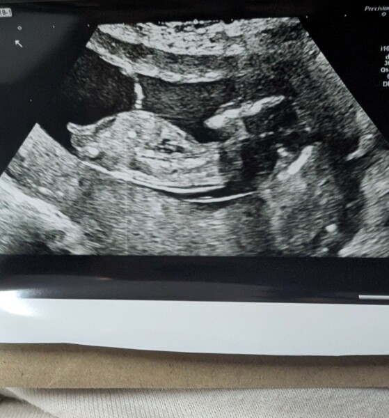 Does this look like a girl?!