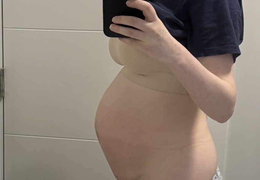6 days post c section, is this normal