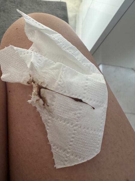 Inplantation bleeding or Start or Period