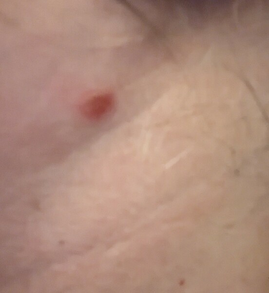 Some kind of spot that won't go