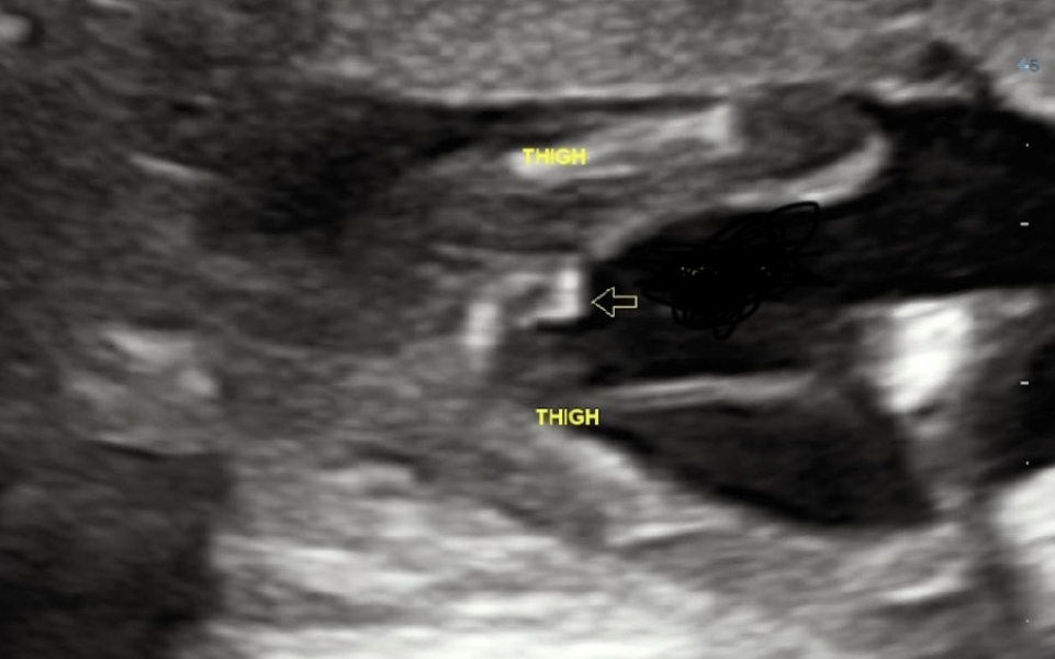 What is the gender of my baby?