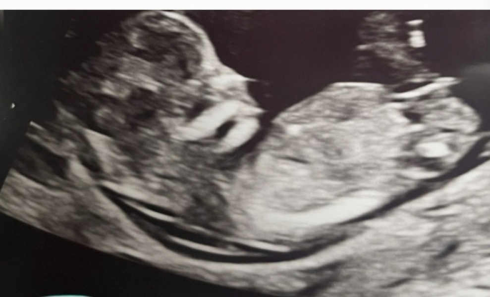 Gender confusion ( help