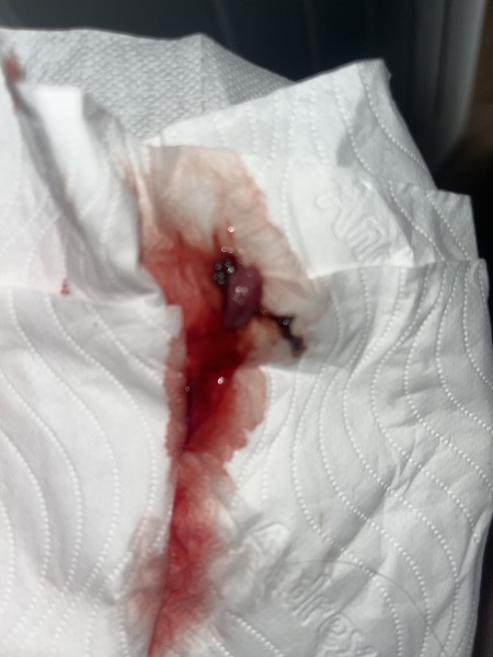 does this look like a miscarriage