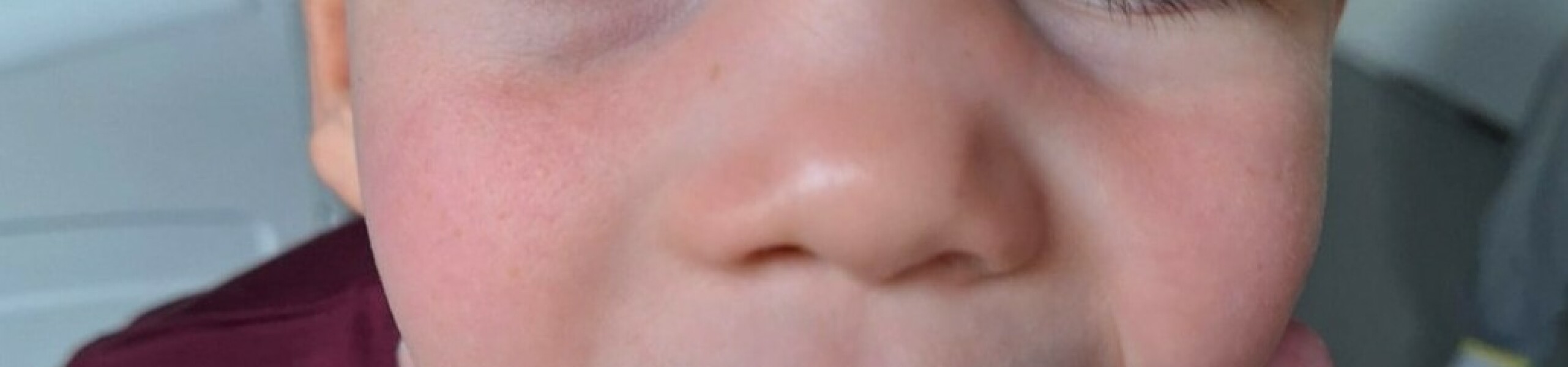 Any ideas what this 'rash' could be?