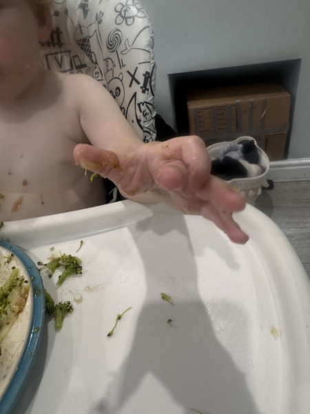 Why does my 2 year old hold his his hands like this?