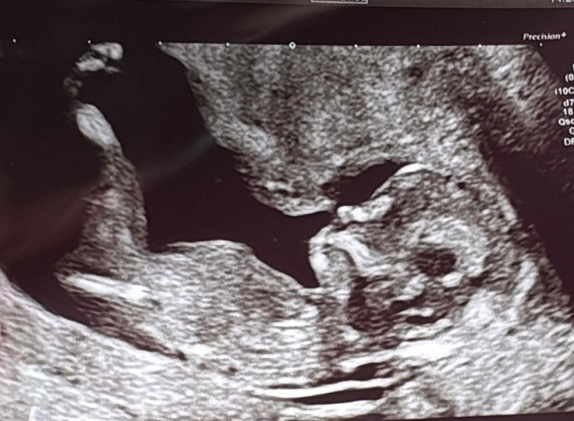 Boy or Girl? :)