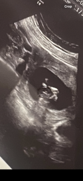 Baby’s early gender