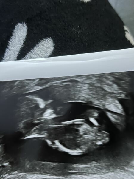 Boy or girl?
