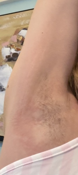 Message from Mitchum regarding skin issues