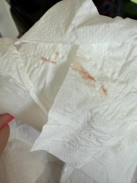 Is this implantation spotting?