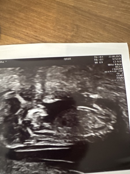 Nub theory guesses on my little baby 🤍