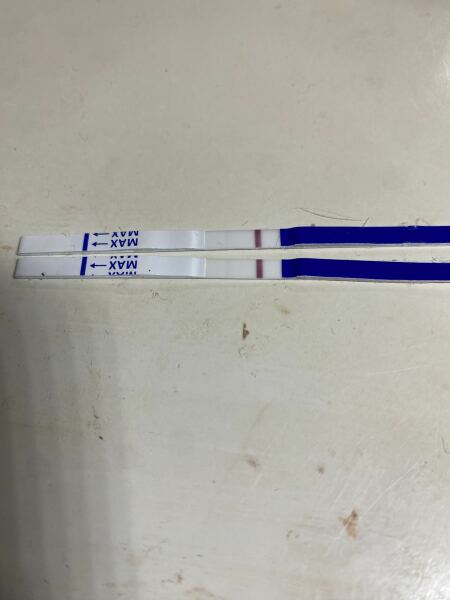 Previous pregnancy HCG or new pregnancy following miscarriage