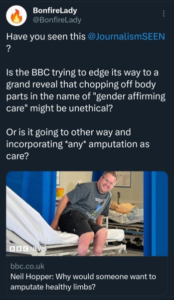 BBC article on Body Integrity Dysmorphia