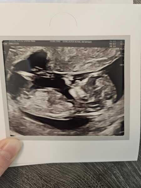 12+5 scan today - is anyone good with gender guesses please?