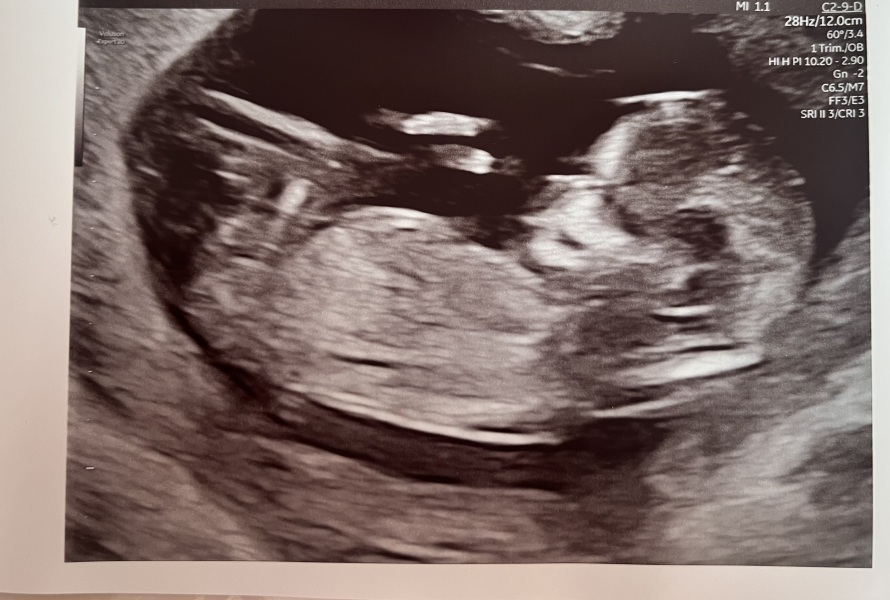 Gender guesses?