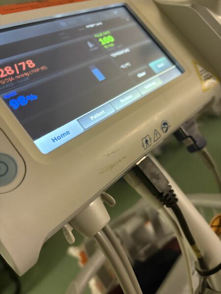 Impact of death on daughter constipated sick and accidents