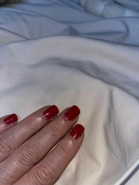 Can I see your nails please?