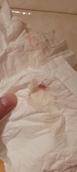 Should I be concerned about bleeding?