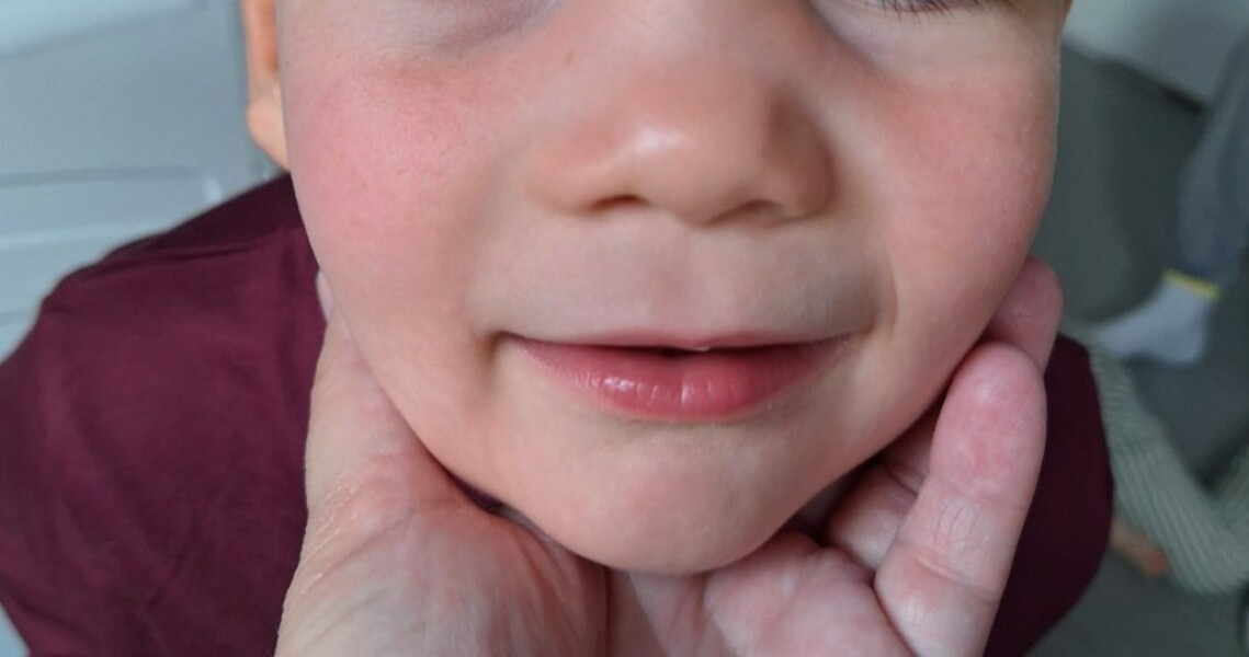 Any ideas what this 'rash' could be?