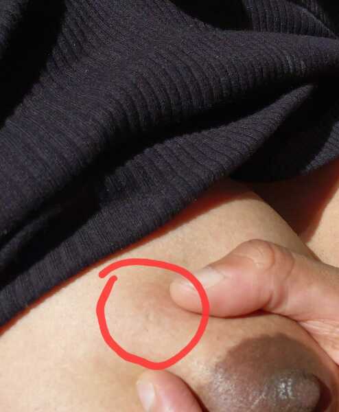 To be freaking out at this tiny dent thing on my breast?