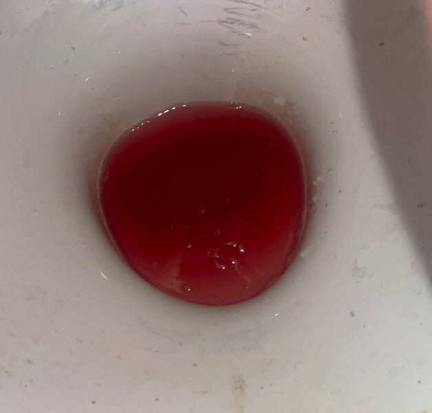Is this implantation bleeding?