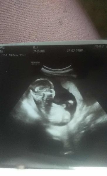 Gender help -19 week 2 days