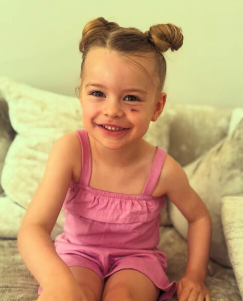 Haemangioma/propranolol