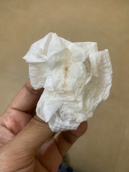 Is this implantation bleeding?