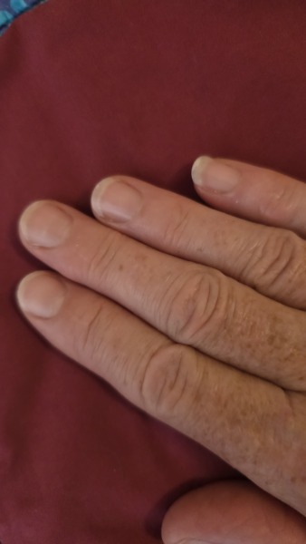 I need a miracle cure for my poor nails