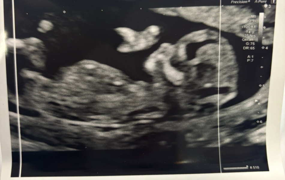 Gender guesses please!