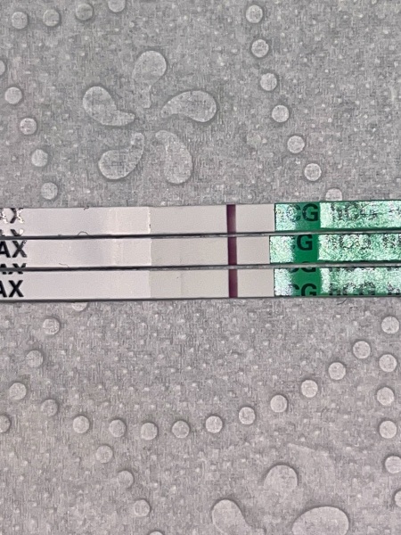 What do you see on these tests?
