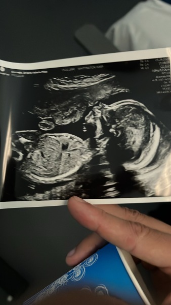 Due January 2026 - thread 2