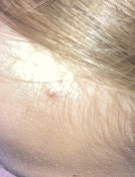 What is at the tip of DD’s spot?