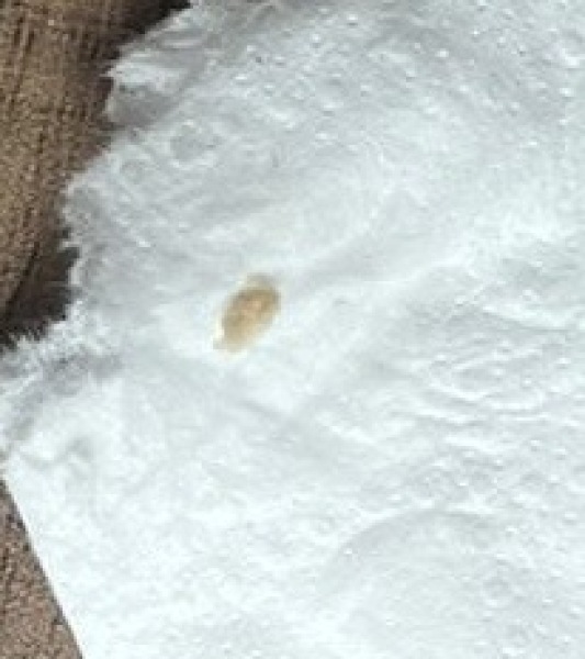 Has anyone experienced this?