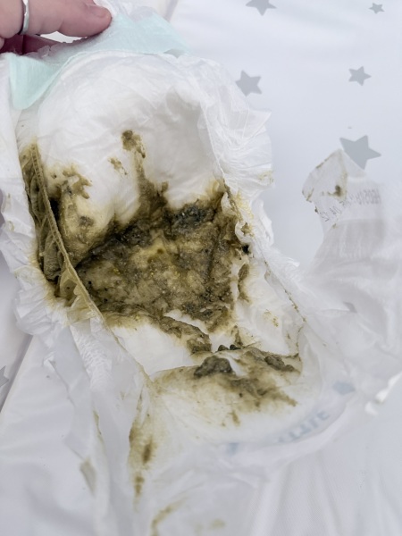 Puramino poo- is this normal?