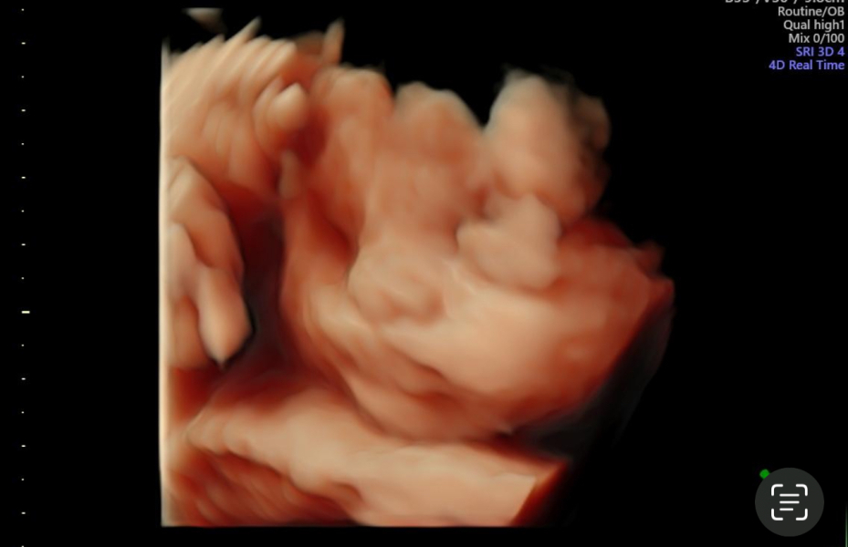3D scan