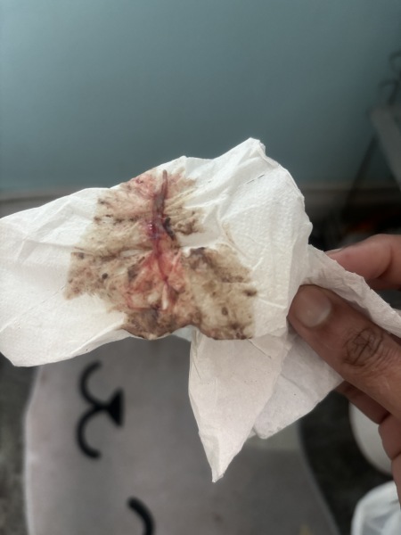 Persistent cramping in early pregnancy - is this normal?