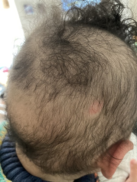 Help! What is this on baby’s scalp ??