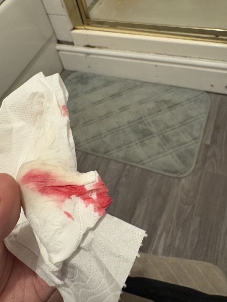Bleeding in third trimester