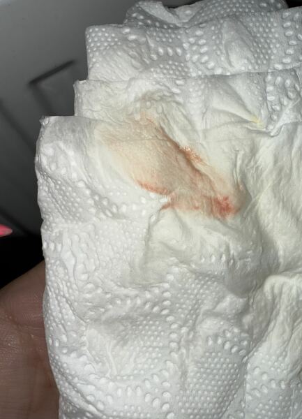 Is this implantation spotting?