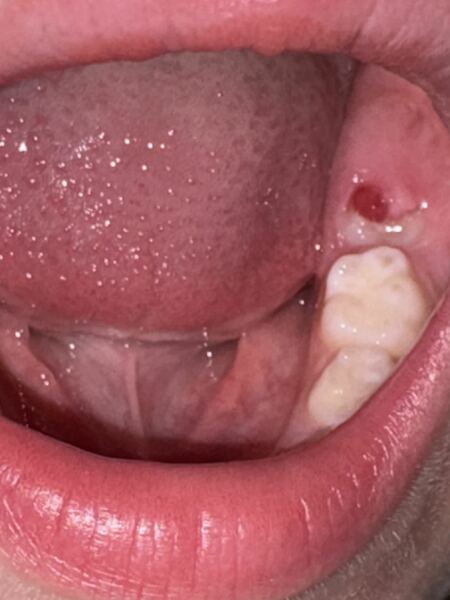 Any dentists around?