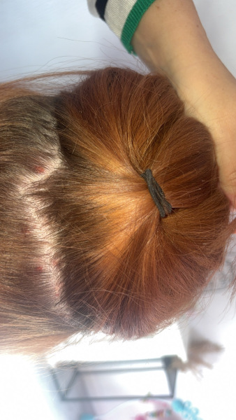Hair scalp