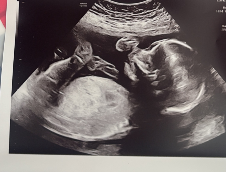 Boy or girl * Just for fun *